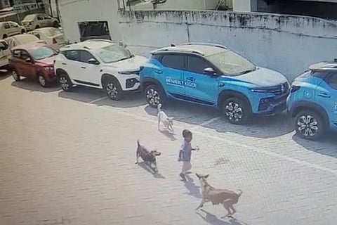Four-yr-old boy in Hyderabad mauled by street dogs