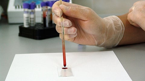 A gloved hand places a drop of blood on a glass slide in a laboratory setting for microscopic examination. Used as a representation image 