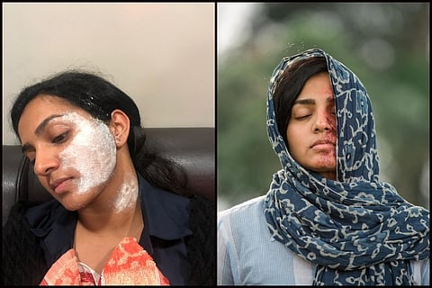 Meet the prosthetic artists behind Parvathy's acid attack survivor look in 'Uyare'