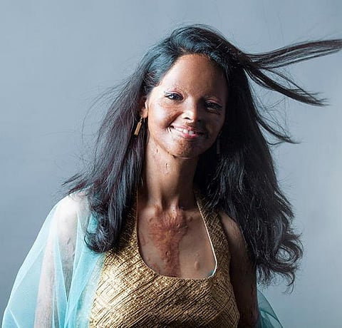 You can help: Acid attack survivors in a photo shoot for a collective dream