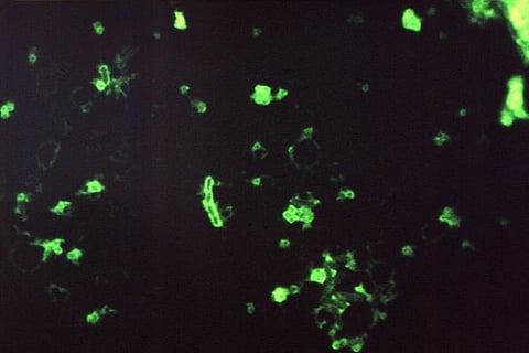 Plague outbreak: where does it still exist and could it spread?