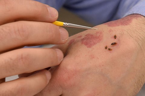 Bed bugs 
