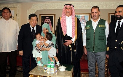 Kambal na magkadikit sa atay paghihiwalayin