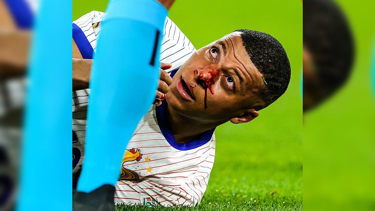 BLOODY PERFORMANCE France edges Austria as Mbappe suffers broken nose