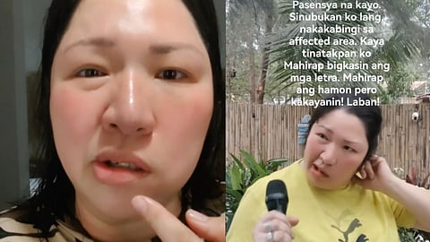 Frenchie Dy shares her struggle with Bell's Palsy for the third time