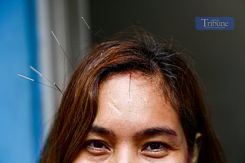 Residents of Barangay 627 in Chinatown, Manila, receive free acupuncture treatments on 9 March 2025. A key component of traditional Chinese medicine for over 2,000 years, acupuncture involves inserting fine needles into the skin to address health issues, particularly pain and inflammation.