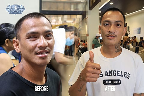 An artificial eye from Tzu Chi Eye Center restores Angelito Albo’s self-esteem.