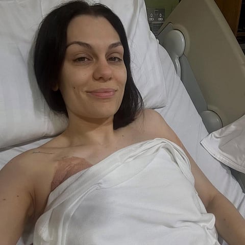 BRITISH singer Jessie J recently underwent surgery after being diagnosed with breast cancer earlier this June.
