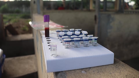 THE TUSLOB Rapid DNA Extraction Kit and VIPtec ASFV Real-time PCR Detection Kit, proudly developed by Filipino scientists under the DOST’s Virology and Vaccine Research Program, are part of the country’s science-driven response to African Swine Fever.