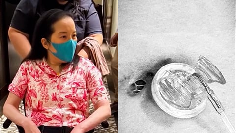 Kris Aquino's recent health update. 