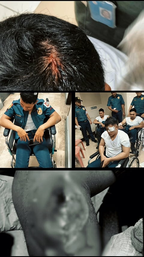 PROTEST WOUNDS | Injured PRO3 personnel receive medical treatment for wounds sustained during the violent protest in Manila. The images depict head injuries, eye trauma, and other physical ailments.| Franco Regala