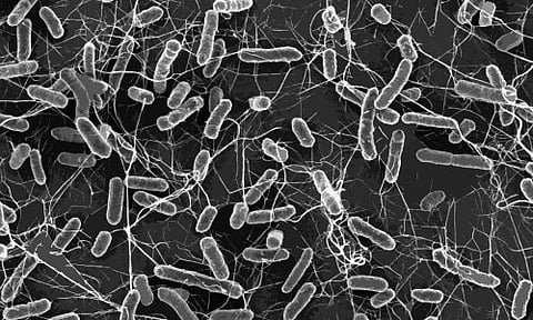 Spread of drug-resistant superbugs surging