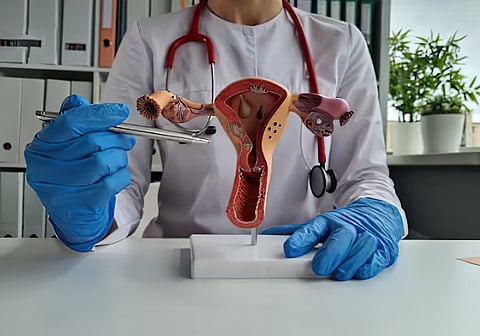 
Endometriosis is a condition in which tissue similar to the lining of the uterus (endometrium) grows outside the uterus, leading to pelvic pain and potential fertility issues.