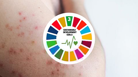 DoH-XI holds measles-rubella vax activity