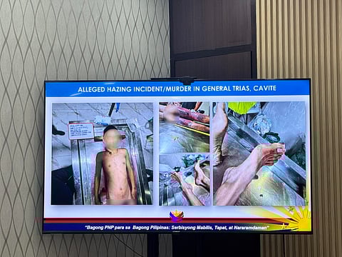 Cavite cops hunt suspects in death of 19-year-old hazing victim
