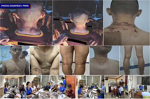 Remulla vows charges vs 3 PNPA cadets over hazing