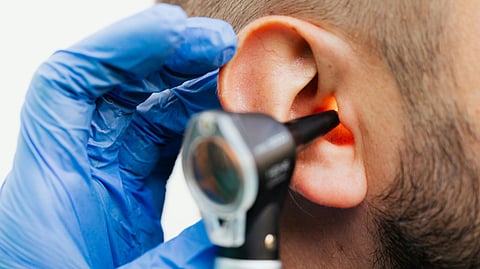 First gene therapy to treat hearing loss okayed
