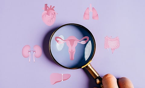 Uplifting hopes to womanhood: PCOS renamed as ‘PMOS’