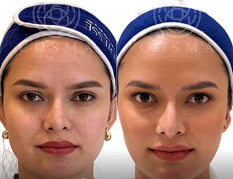 BEAUTY queen Gabrielle Camille Basiano’s before and after transformation.