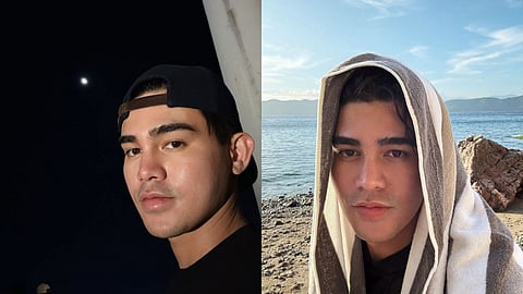 Inigo Pascual injures self in mall show