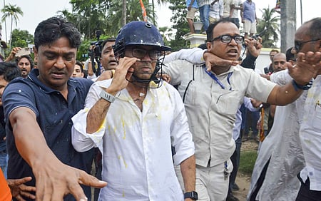 Abhishek Banerjee hospitalised in Kolkata after attack in Bengal’s Sonarpur