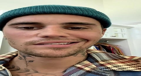 Justin Bieber struck with facial paralysis, shows postponed