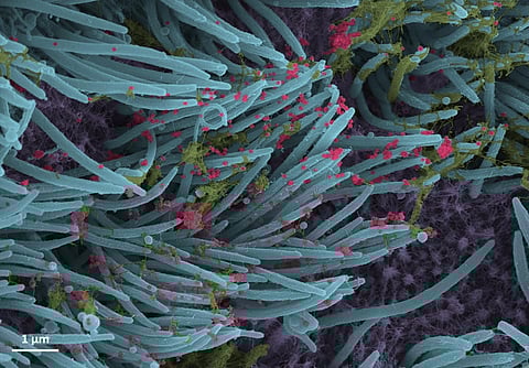Previous Covid infection may improve performance of antibodies