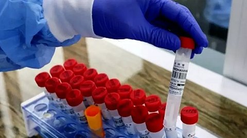 New study explores AI in developing antibiotics with less side-effects