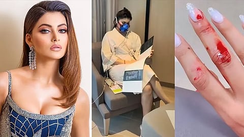 Urvashi Rautela, Urvashi Rautela Minor Cut, Urvashi Rautela Hospitalized, Urvashi Rautela Increasing Rape, What happened to Urvashi Rautela, Urvashi Rautela Indian Media Minor Cut