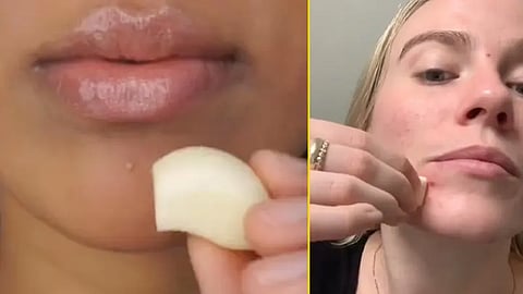 Beauty Influencers Garlic Rubbing Trend