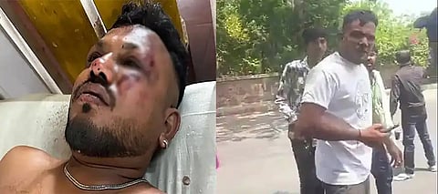 Air India Survivor Ramesh Viswashkumar