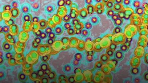 What is Strep A infection? A serious threat among children, its symptoms and everything for you to know