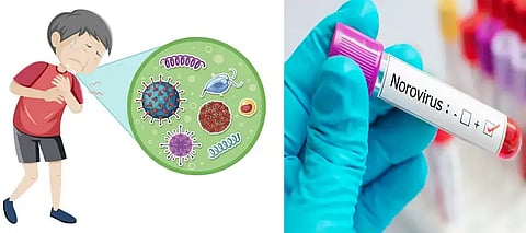 Norovirus outbreak, what you need to know about the ‘winter Vomiting Bug’