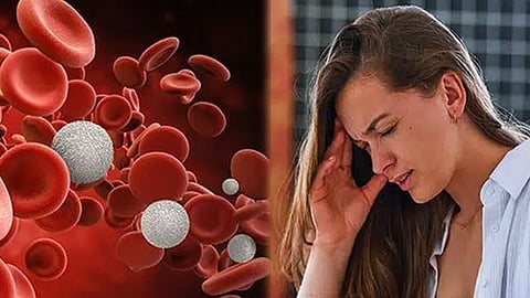 Anemia  