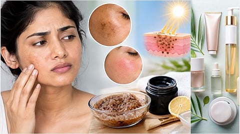 Information about pigmentation