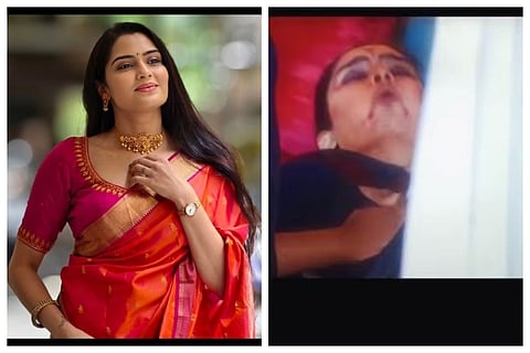 ಸಂಗೀತಾ ಭಟ್ ಆರೋಗ್ಯದಲ್ಲಿ ಏರುಪೇರು; ಆಸ್ಪತ್ರೆಗೆ ಶಿಫ್ಟ್..BBK13