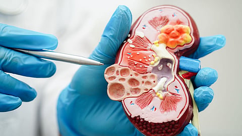  Kidney Health  