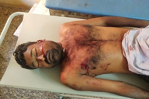 17 HKR Death