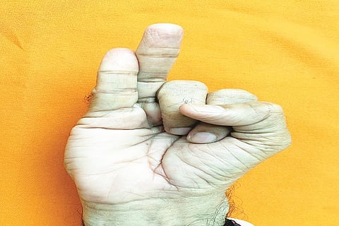 Muthrashaya Mudra [ Kapha Nasaka Mudra]
