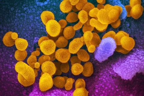 Corona virus 22 Feb 20