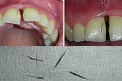 Mouth 6 Feb 20