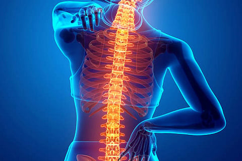 Spondilitis
