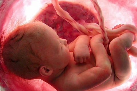 reproduction