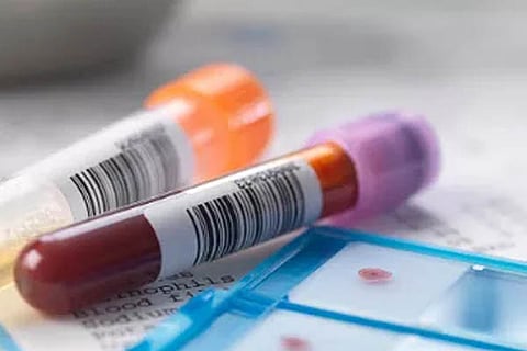 Blood Group