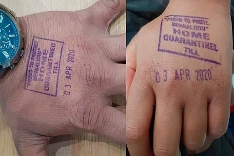 Corona Stamping on hand 19 MAR 20