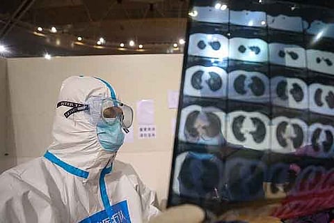 Corona Virus Patient