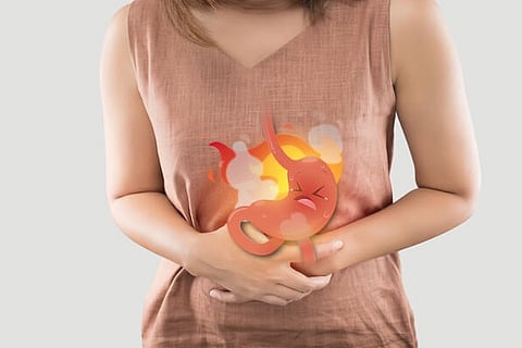Gastric 3 March 20