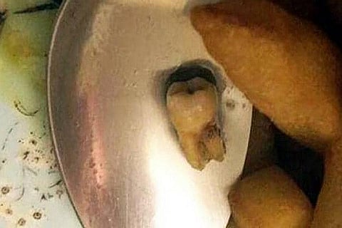 Pork Curry and human teeth 1 MAR 20