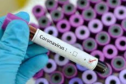 Suspected Coronavirus 15 march 20