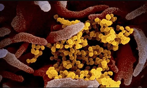 corona virus 18 mar 20